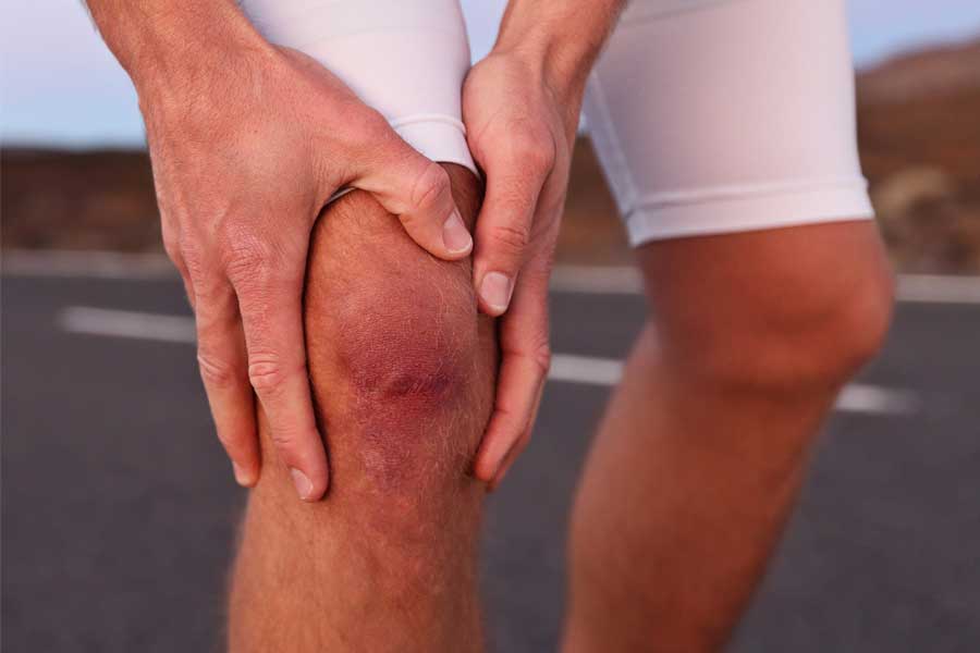 why your knees might need physical therapy